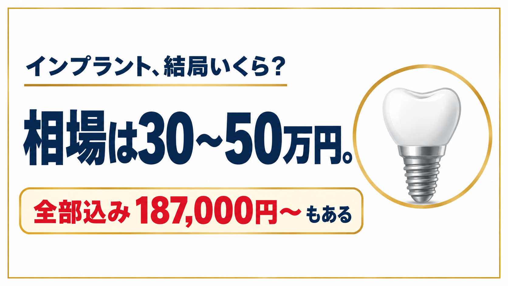 インプラント、結局いくら？相場は30〜50万円。全部込み187,000円〜もある
