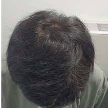 症例E アフター