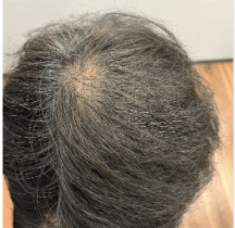 症例E ビフォー